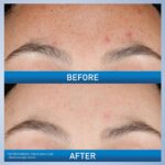 CeraVe Retinol Serum: Brightens, Minimizes Pores, Heals Acne Marks. - Image 3