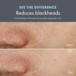 Origins Clear Improvement Mask: Blackhead Control with Salicylic Acid - Image 4
