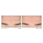 RoC Retinol Deep Wrinkle Serum Cleanser with Niacinamide - Image 2