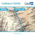 CeraVe Anti-Dandruff Shampoo: Soothes Itchy Scalp, Eliminates Flakes. - Image 3