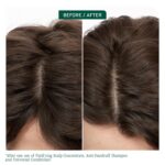 Biolage Scalp Sync: Exfoliating Treatment for All Scalp Types. - Image 2