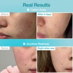 Numbuzin No.1 Sheet Mask: Hydrating & Soothing for Acne-Prone Skin - Image 2